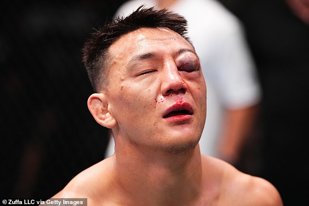 UFC Fighter Rongzhu Suffers Severe Eye Injury from Elbow Strike During UFC Vegas 97, Raising Concerns About Possible Vision Loss