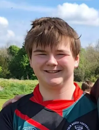 Teen Rugby Player Sam Staple Tragically Passes Away in Tupholme, Lincolnshire, After Grazing His Shin During a Match