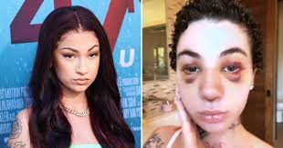 Bhad Bhabie Opens Up About Undergoing a Nose Job While Battling Cancer and Facing Criticism in the US