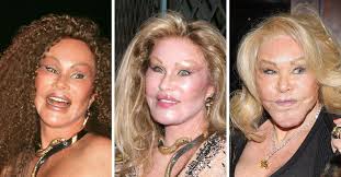 Jocelyn Wildenstein, The Catwoman Known for Her Facial Transformation, Passes Away in Paris at 84