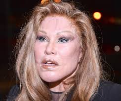 Jocelyn Wildenstein passes away at 84 after suffering a pulmonary embolism in Paris leaving behind a controversial legacy of beauty and wealth.