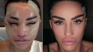 Katie Price shares her plans for another round of cosmetic surgery during her visit to a clinic in Turkey