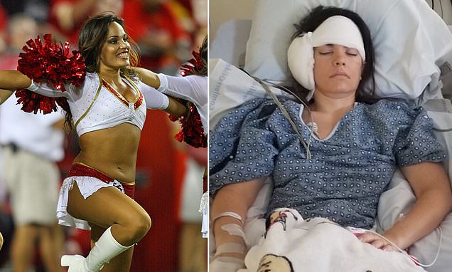 Former Kansas City Chiefs Cheerleader Fights for Her Life After Years of Misdiagnosis Leads to Rare Brain Tumor Discovery