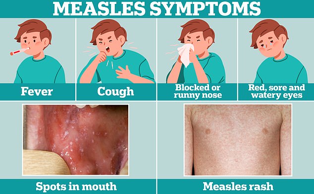 Measles outbreak in the United States intensifies as infected traveler at LAX exposes passengers to highly contagious disease