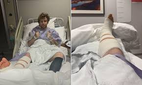 Tom Grennan Shares Shocking Leg Injury News and Announces Recovery Journey After Hospitalization in the US