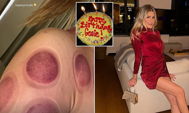 Eugenie Bouchard shares intense cupping therapy experience as she transitions from New York birthday celebrations to rigorous recovery