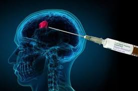 Millions of South African Women Face Health Concerns as Study Links Popular Contraceptive Injection to Brain Tumors