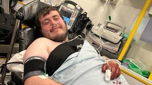 Heroic Cardiff Man Endures Vicious Dog Attack While Saving Mother and Baby in Llanrumney