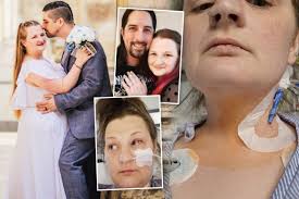 Aimee Chapman Shares How Mounjaro Weight Loss Injection Caused Life-Threatening Liver Failure and Oesophagus Injury in Southampton