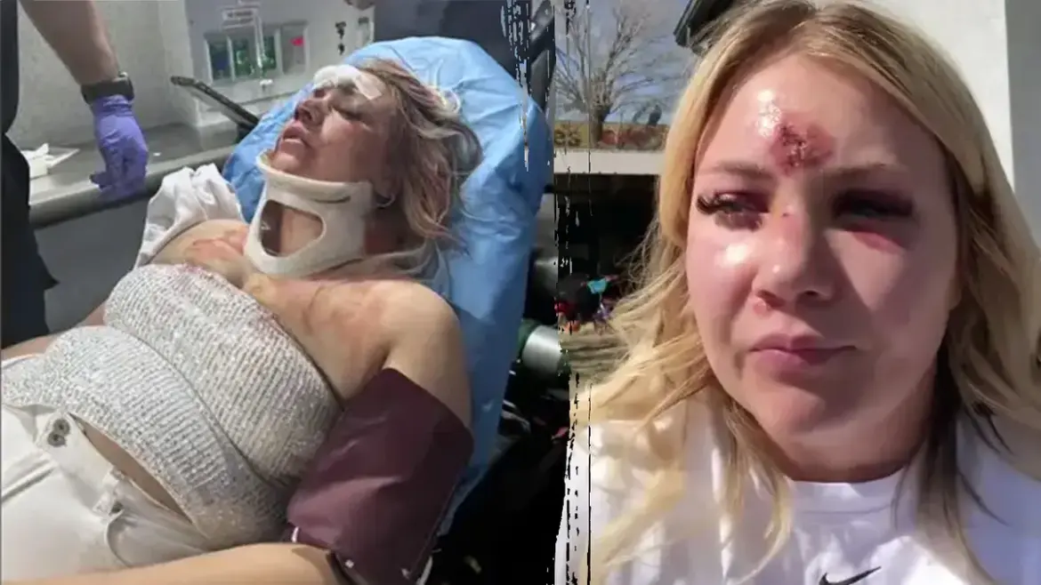 Dallas Nightclub Assault Leaves Bride with Broken Nose and Missing Teeth Yet She Still Says I Do in Kansas Ceremony
