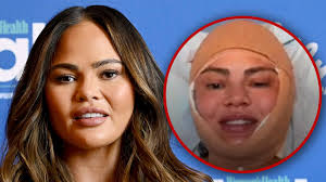 Chrissy Teigen Reveals Undergoing Hairline Lowering Surgery in Hospital Photo Shared on Instagram