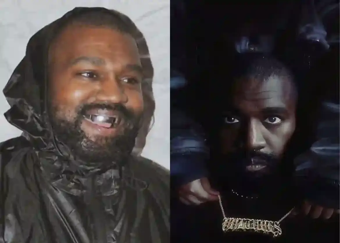 Kanye West and Bianca Censori Sue Dentist Dr. Thomas Connelly Over Alleged Nitrous Oxide Addiction in Los Angeles