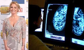 NHS Plans to Offer Breast Cancer Screening to Women in Their 30s Across England After Groundbreaking Manchester Study