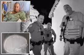 San Diego Police Sergeant Survives Life-Threatening Headshot and Defies Odds to Return to Duty After Intense Brain Injury Recovery
