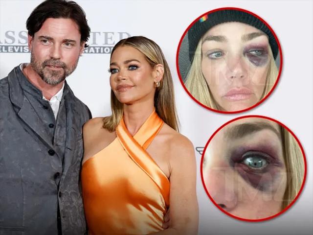 Aaron Phypers and Denise Richards