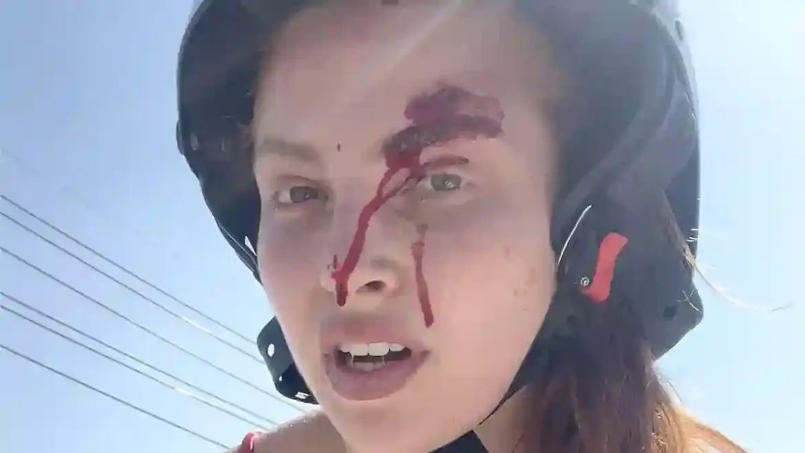 Love Island star Chanse Corbi films herself bleeding after motorbike crash while wearing bikini on busy road in Thailand