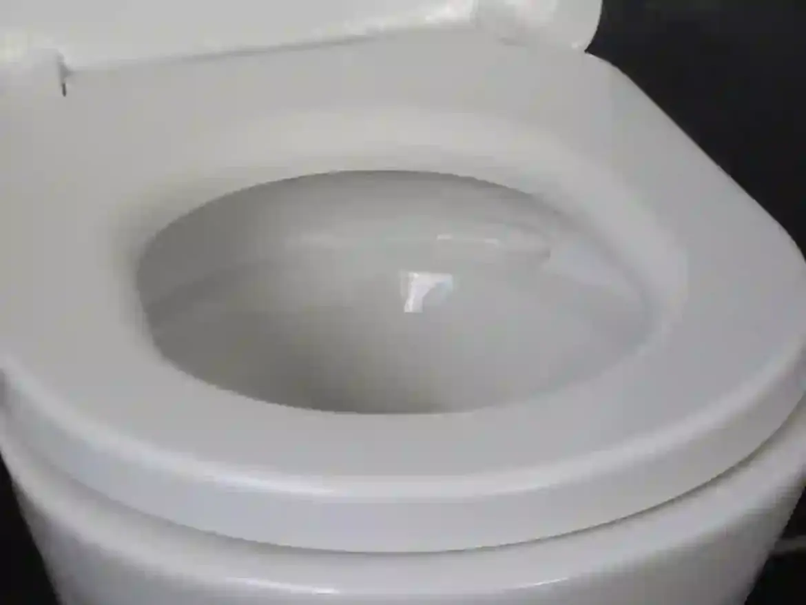 Health Experts Explain How Cloudy Urine Signals Kidney Disease Diabetes or Infection Across the United States
