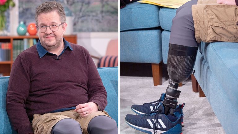 Celebrated doctor from Truro confesses in Crown Court that he cut off his own legs on purpose and lied about sepsis to pocket nearly half a million pounds from insurers