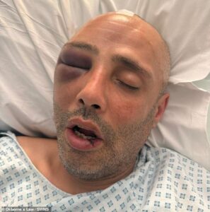 Father Calls for Legal Reform After Suffering Near-Fatal E-Bike Collision in Surbiton Southwest London 3 E-Bike