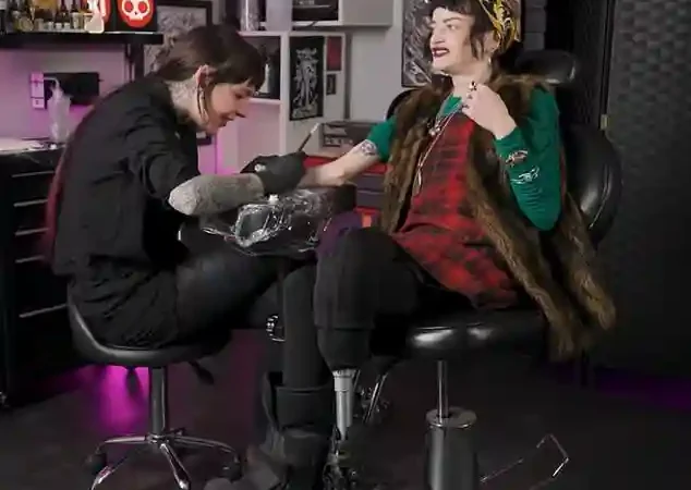 Ruth Codd Reveals She Has Undergone Second Leg Amputation to Improve Quality of Life in Ireland 14 Ruth Codd