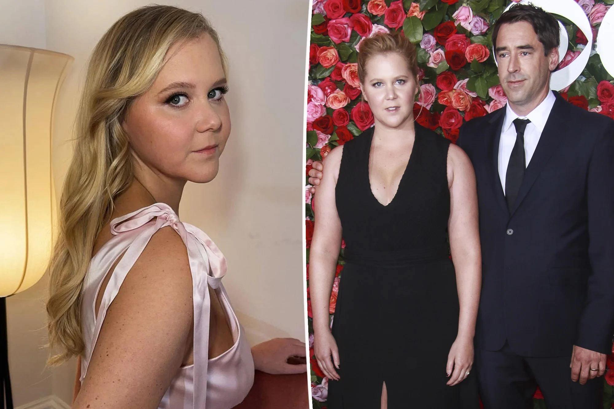 After sharing intimate hospital memories, Amy Schumer confirms separation from husband Chris Fischer and emphasizes amicable relationship in public statement