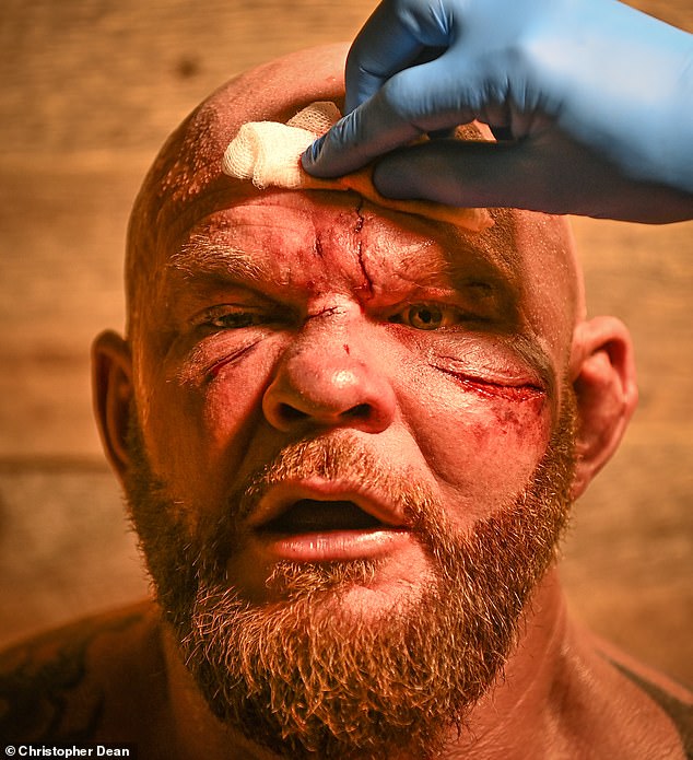 Dorian Darch battles through brutal bare-knuckle injuries in Cardiff as fighters risk it all for glory and pay