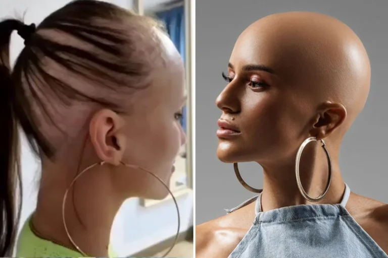 Wearing Hairpieces