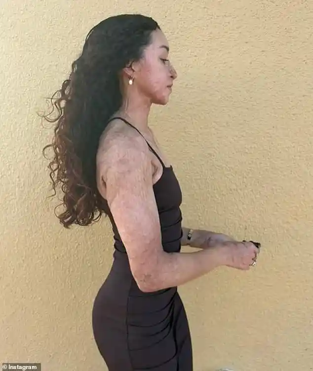 Davina Licon Survives Brutal Acid Attack in Hawaii and Fights for Justice as Her Alleged Attacker Faces Trial for Attempted Murder