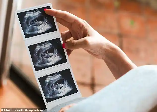 NHS faces backlash as midwives are trained to present benefits of cousin marriage despite documented health risks in the United Kingdom