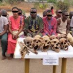 Police find suspected human bones hidden in luggage