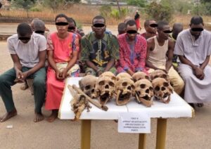 Police find suspected human bones hidden in luggage