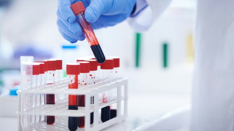 Blood Test