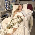 Lindsey Vonn Faces Severe Leg Injury After Crashing During Downhill Final at Milan-Cortina Winter Olympics