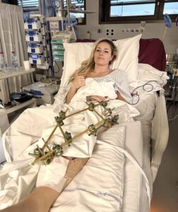 Lindsey Vonn Faces Severe Leg Injury After Crashing During Downhill Final at Milan-Cortina Winter Olympics