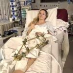 Lindsey Vonn Undergoes Multiple Surgeries and Faces Grueling Recovery After Horror Leg Crash at Winter Olympics in Italy