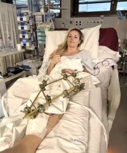 Lindsey Vonn Undergoes Multiple Surgeries and Faces Grueling Recovery After Horror Leg Crash at Winter Olympics in Italy