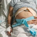 BBC investigates recurring maternity care failures affecting bereaved families across Morecambe Bay, Shrewsbury & Telford, and East Kent NHS Trusts in England