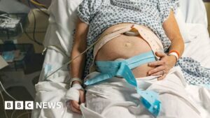 BBC investigates recurring maternity care failures affecting bereaved families across Morecambe Bay, Shrewsbury & Telford, and East Kent NHS Trusts in England