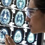 Scientists detect hidden Alzheimer’s brain changes using advanced scans in Lancet studies across United States and Canada research centres