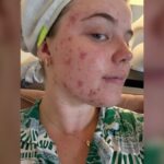 Doctors Told Me to 'Wait It Out' for 13 Years... The Real Solution Left Me Speechless