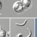 More Than 170 Cyclosporiasis Cases Reported in Michigan as Officials Warn of Expanding Parasitic Outbreak