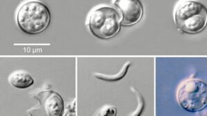 More Than 170 Cyclosporiasis Cases Reported in Michigan as Officials Warn of Expanding Parasitic Outbreak