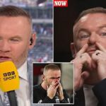 Wayne Rooney Nose Surgery
