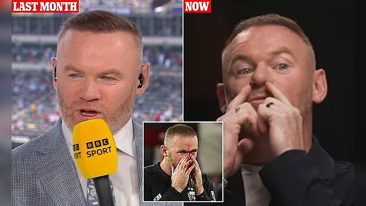 Wayne Rooney Nose Surgery