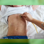 Fifth Measles Death Hits Pennsylvania as State Records 943 Cases Across 39 Counties