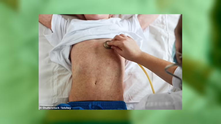 Fifth Measles Death Hits Pennsylvania as State Records 943 Cases Across 39 Counties