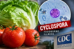 Michigan Confirms First US Deaths Linked to Cyclospora Parasite as Thousands Fall Ill Nationwide