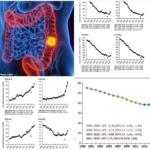 Colon Cancer Rates Climb Despite Widespread Screening as Scientists Investigate Generational Risk