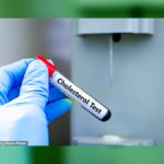 Doctors Warn of Overlooked Cholesterol Risk as ‘Healthy’ Patients Face Hidden Heart Danger